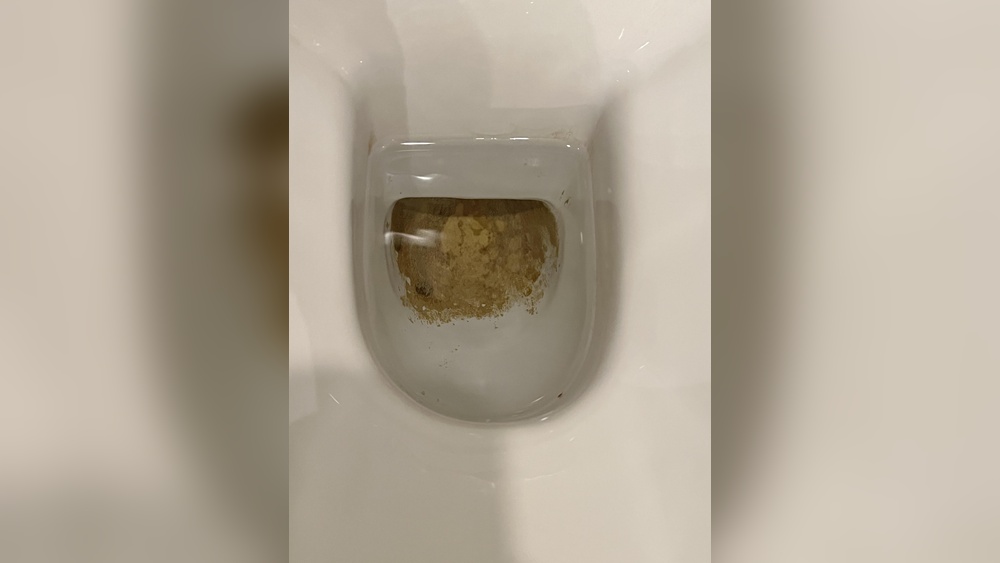 How To Get Poop Off Toilet Bowl Without Brush
